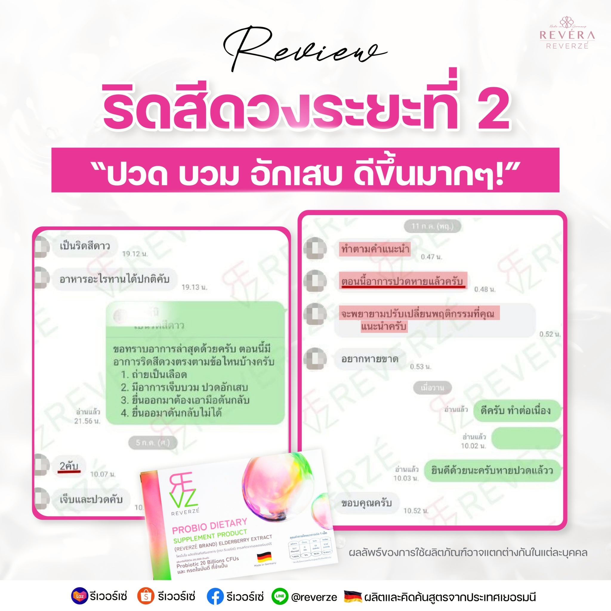 ปวด บวม อักเสบ ตอนนี้ดีขึ้นมาก! (รีวิวลูกค้าจริงกับ โรคริดสีดวงระยะที่ 2)