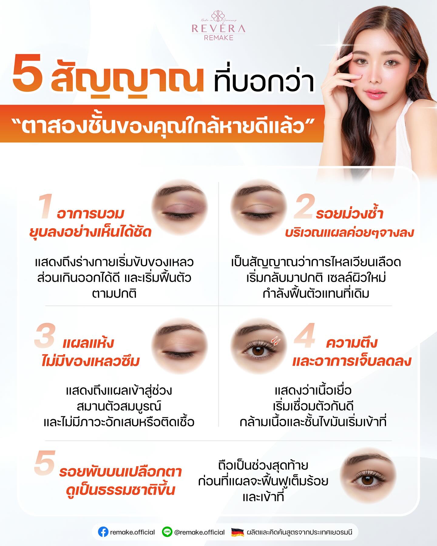 5 สัญญาณที่บอกว่า “ตาสองชั้นของคุณใกล้หายดีแล้ว”