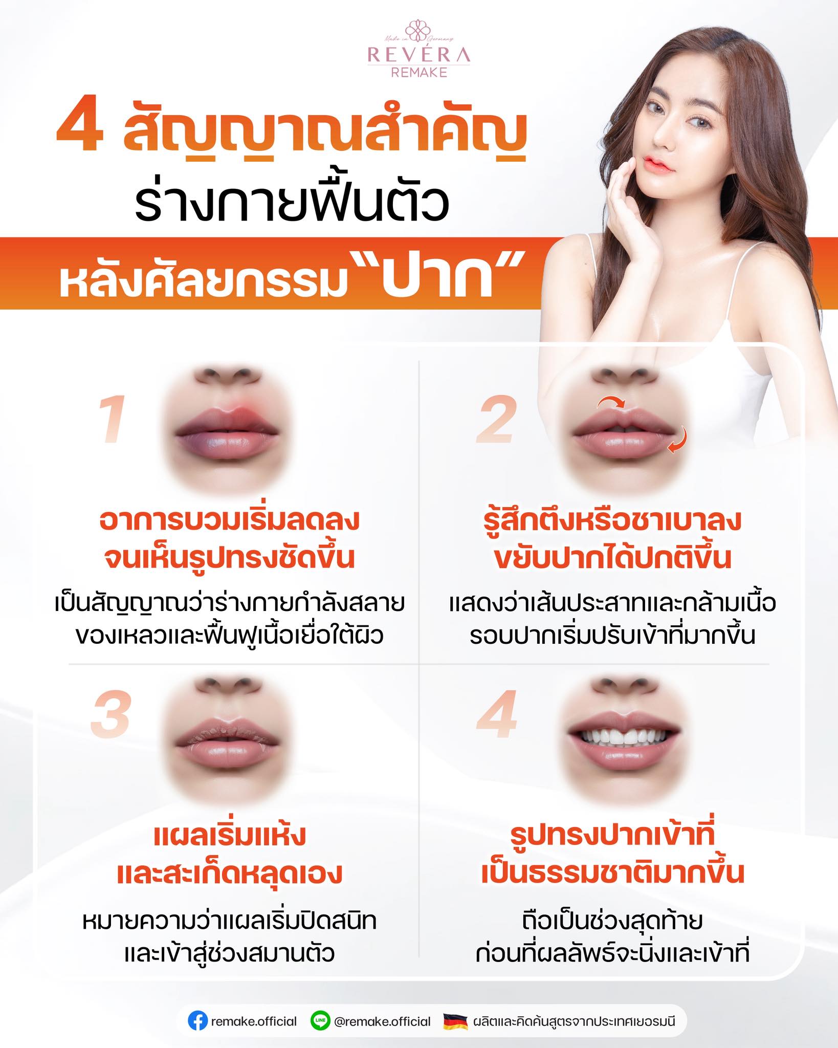 สังเกตเป็น = สวยไวแน่.!! 4 สัญญาณสำคัญ ร่างกายกำลังฟื้นตัวหลัง “ศัลยกรรมปาก”