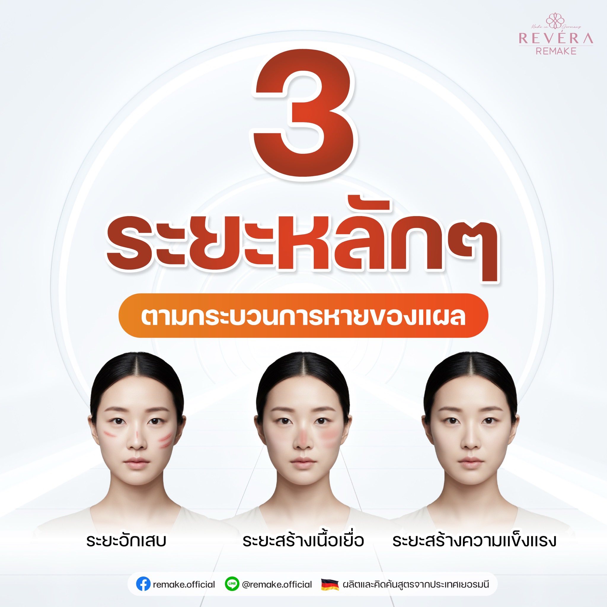 3 ระยะหลักของการฟื้นฟูร่างกาย ที่คุณต้องรู้!!