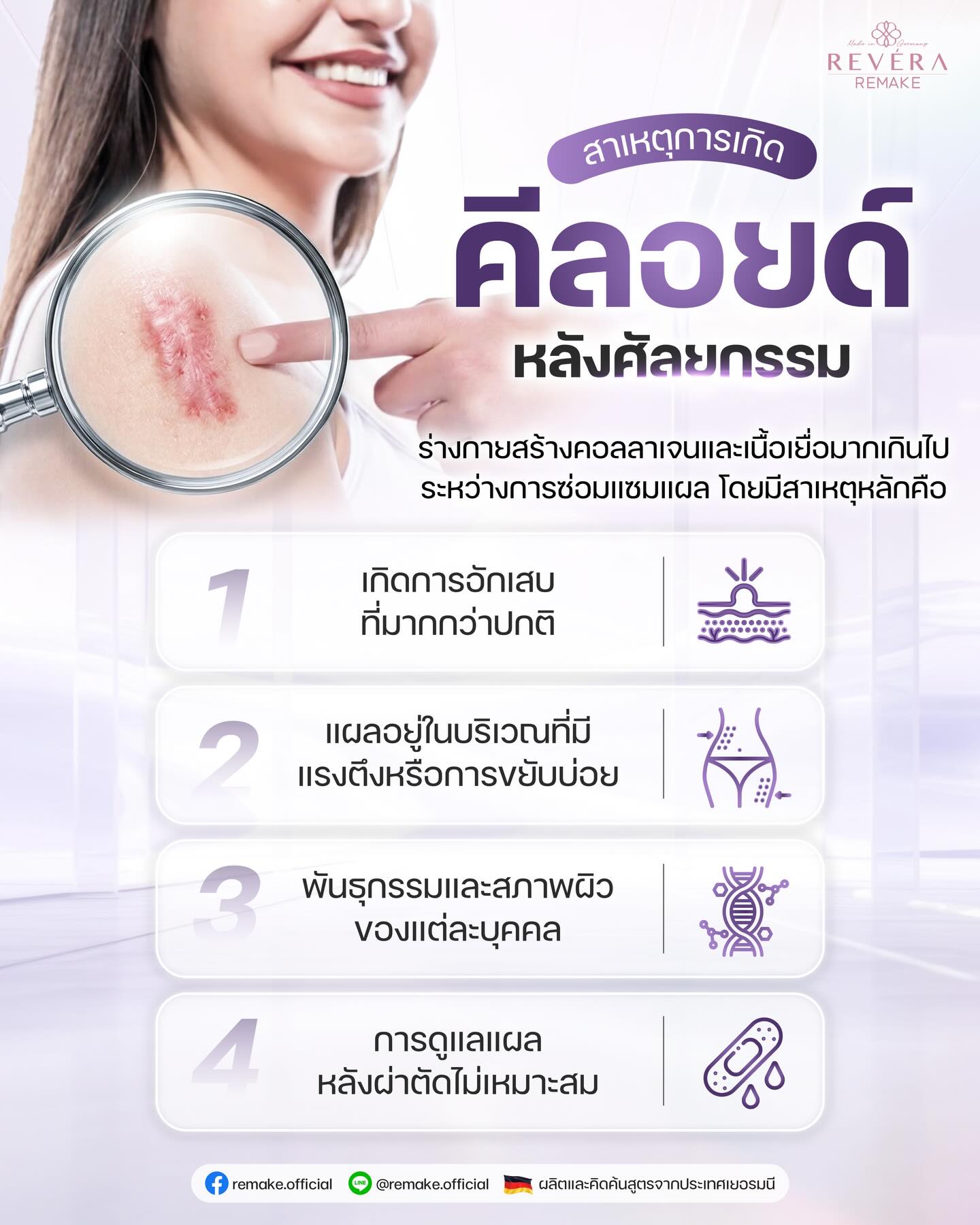 “คีลอยด์หลังศัลยกรรม” สิ่งที่คนทำศัลยกรรมมักมองข้าม!