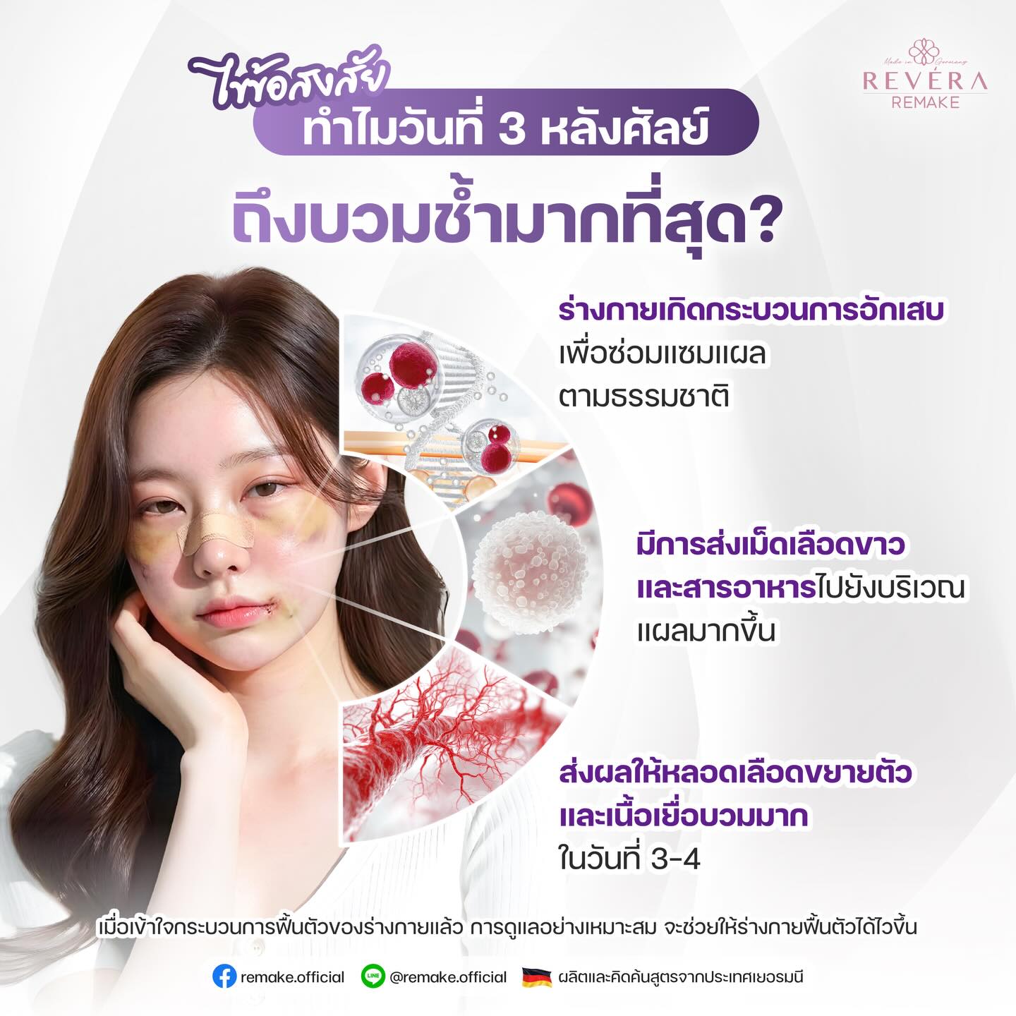 3 วันหลังศัลยกรรม ทำไมร่างกายบวมช้ำมากที่สุด! (โพสต์นี้มีคำแนะนำที่คุณต้องรู้)