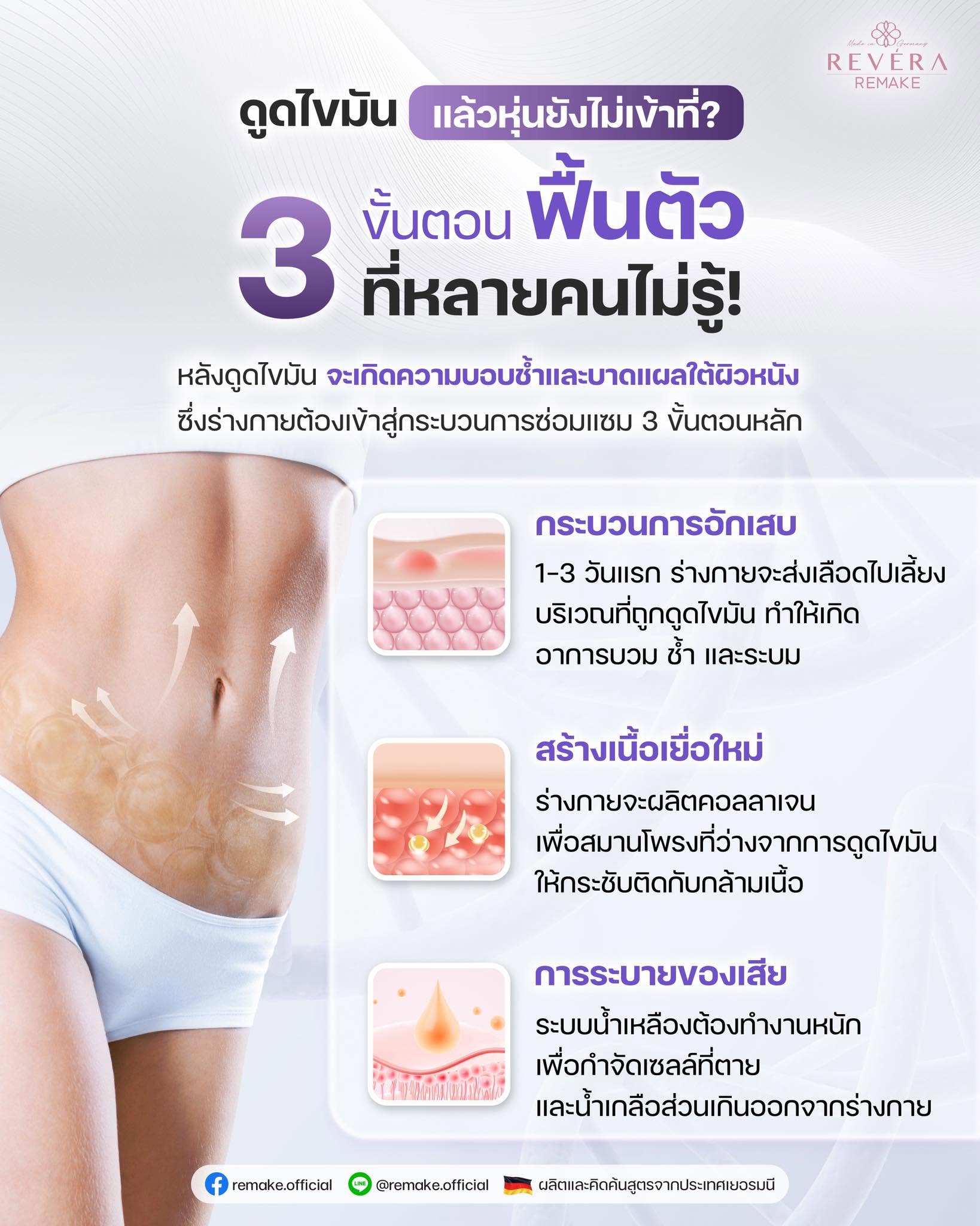ดูดไขมันแล้วหุ่นยังไม่เป๊ะ? ความจริง “3 ขั้นตอนฟื้นตัว” หลังดูดไขมันที่หลายคนไม่เคยรู้!